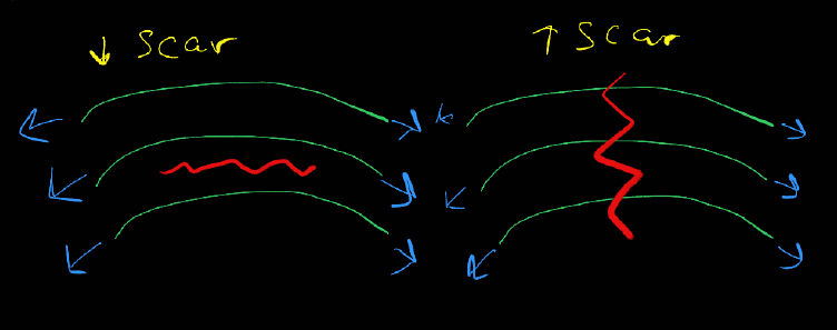 skin-tension